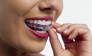 Invisalign®